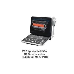 Z60 (Portable USG)